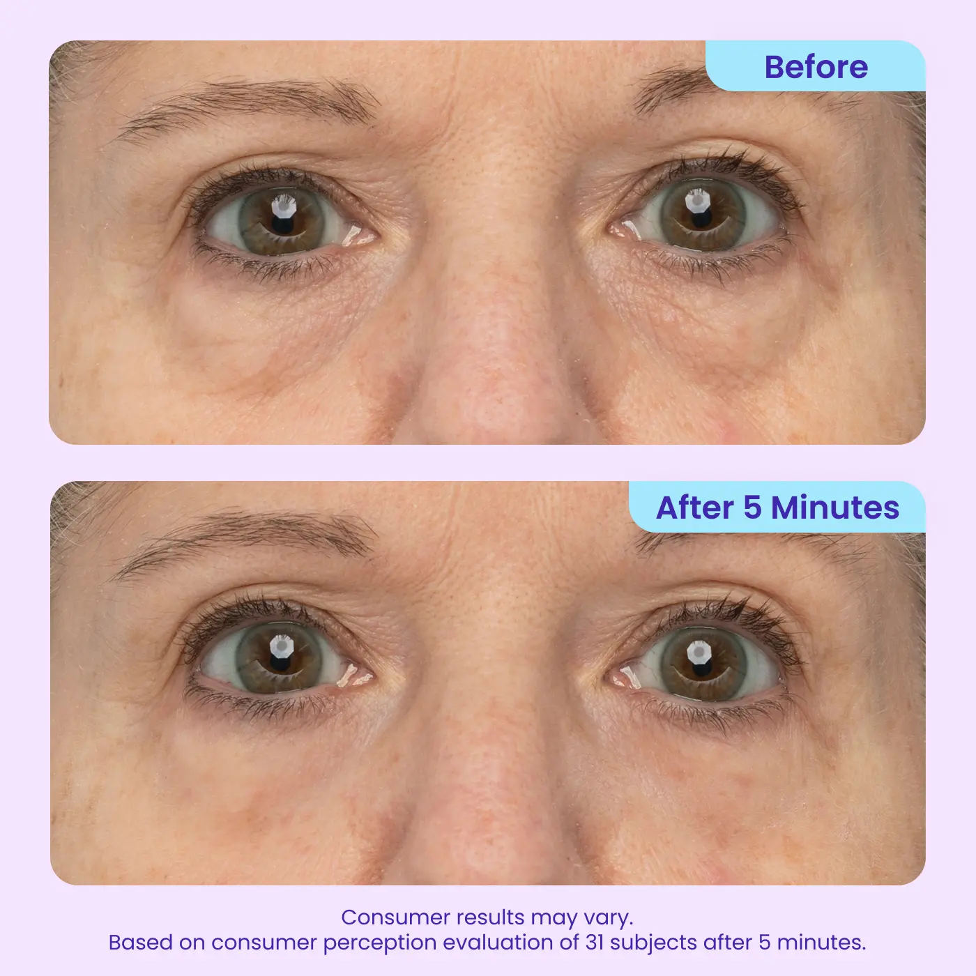 Voezra® Eye Bag Instant Eraser, Tightens, Firms & Blurs Wrinkles