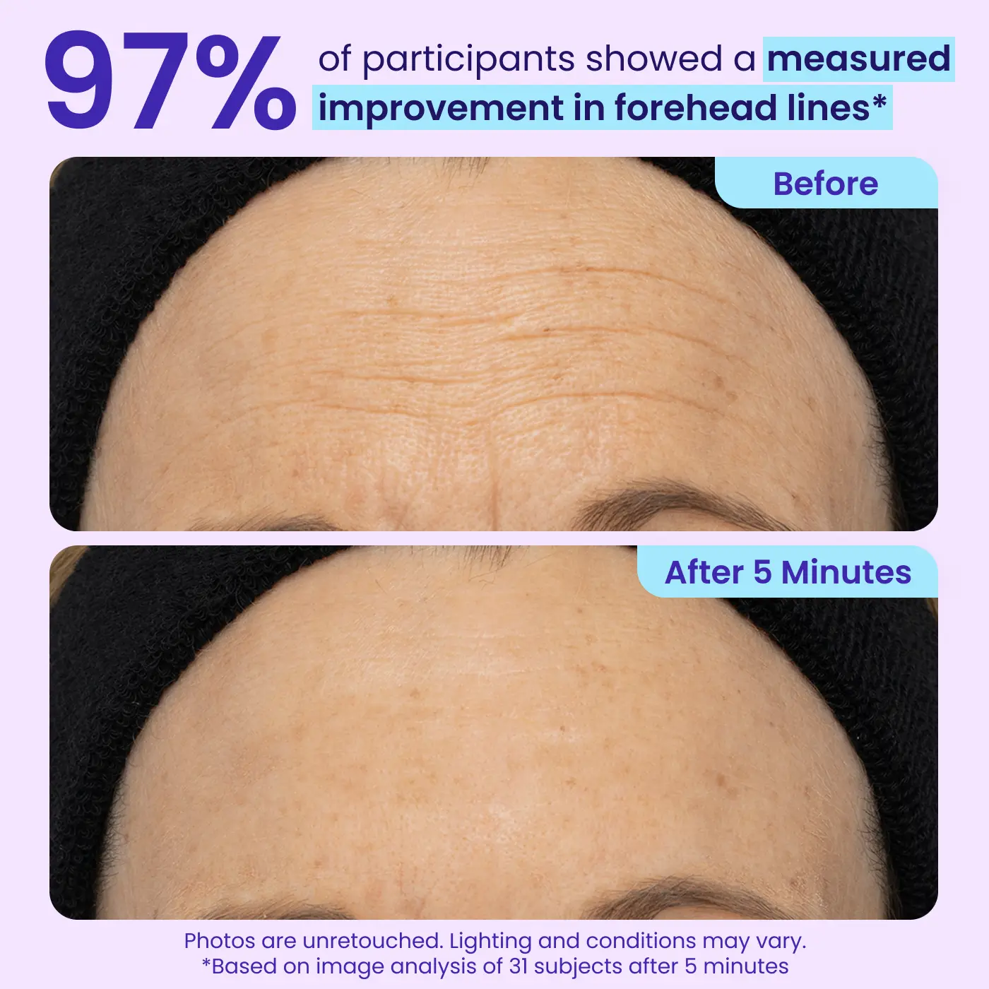 Voezra® Eye Bag Instant Eraser, Tightens, Firms & Blurs Wrinkles